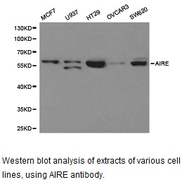 Western blot.