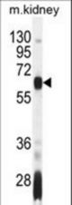 AIRE Antibody western blot of mouse kidney tissue lysates (35 ug/lane). The AIRE antibody detected the AIRE protein (arrow).