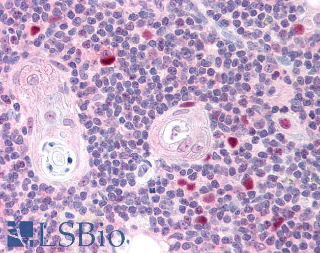 Anti-AIRE antibody IHC of human thymus. Immunohistochemistry of formalin-fixed, paraffin-embedded tissue after heat-induced antigen retrieval. Antibody LS-B1741 concentration 5 ug/ml.