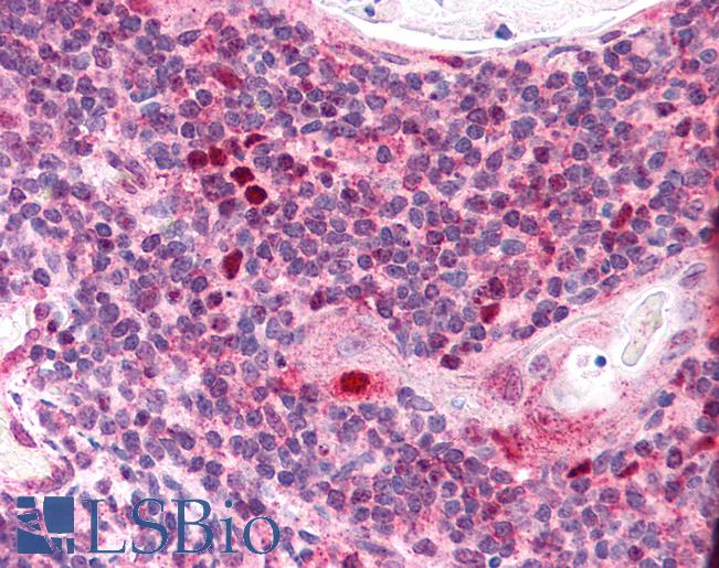 Anti-AIRE antibody IHC of human thymus. Immunohistochemistry of formalin-fixed, paraffin-embedded tissue after heat-induced antigen retrieval. Antibody LS-B1740 concentration 5 ug/ml.
