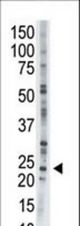 The anti-AK1 antibody is used in Western blot to detect AK1 in CHO cell lysate.