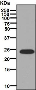 Western blot analysis on fetal muscle lysate using anti-AK1 antibody.