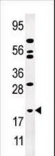 Western blot of anti-AK1 antibody in Jurkat cell line lysate (35 ug/lane). AK1(arrow) was detected using the purified antibody.