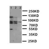 WB of ABCB6 antibody. Lane 1: HELA Cell Lysate. Lane 2: MCF-7 Cell Lysate. Lane 3: A549 Cell Lysate.