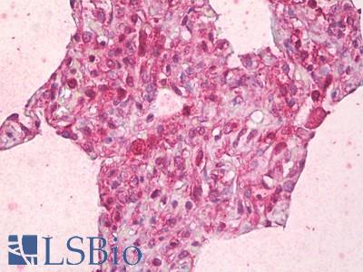 Anti-ABCB7 antibody IHC of human lung, alveoli. Immunohistochemistry of formalin-fixed, paraffin-embedded tissue after heat-induced antigen retrieval. Antibody LS-B7063 concentration 5 ug/ml.