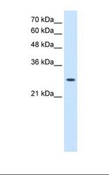 HepG2 cell lysate. Antibody concentration: 2.5 ug/ml. Gel concentration: 12%.