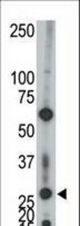 The anti-AK2 antibody is used in Western blot to detect AK2 in Jurkat cell lysate.