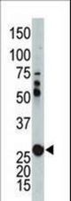The anti-AK2 antibody is used in Western blot to detect AK2 in mouse kidney tissue lysate.