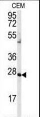 Western blot of anti-AK2 Antibody in CEM cell line lysates (35 ug/lane). AK2(arrow) was detected using the purified antibody.