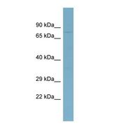 Western blot of Human COLO205. ABCB7 antibody dilution 1.0 ug/ml.