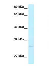 AK3 antibody LS-C146106 Western blot of Mouse Liver lysate. Antibody concentration 1 ug/ml.