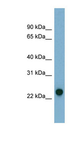 AK3 antibody LS-C107597 Western blot of Fetal liver lysate.