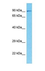 Western blot of ABCB7 Antibody with HeLa Whole cell lysate.