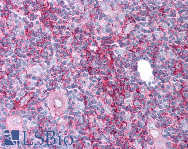 Anti-ABCB7 antibody IHC of human thymus. Immunohistochemistry of formalin-fixed, paraffin-embedded tissue after heat-induced antigen retrieval. Antibody LS-B791 concentration 10 ug/ml.