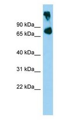 ABCB8 antibody Western Blot of Mouse Muscle.