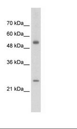 Jurkat Cell Lysate