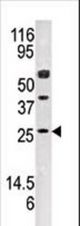 Western blot of anti-AK3 antibody in mouse kidney tissue lysate (35 ug/lane). AK3(arrow) was detected using the purified antibody.