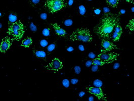 Anti-AK4 mouse monoclonal antibody immunofluorescent staining of COS7 cells transiently transfected by pCMV6-ENTRY AK4.