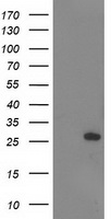 HEK293T cells were transfected with the pCMV6-ENTRY control (Left lane) or pCMV6-ENTRY AK4 (Right lane) cDNA for 48 hrs and lysed. Equivalent amounts of cell lysates (5 ug per lane) were separated by SDS-PAGE and immunoblotted with anti-AK4.