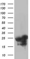 HEK293T cells were transfected with the pCMV6-ENTRY control (Left lane) or pCMV6-ENTRY AK4 (Right lane) cDNA for 48 hrs and lysed. Equivalent amounts of cell lysates (5 ug per lane) were separated by SDS-PAGE and immunoblotted with anti-AK4.