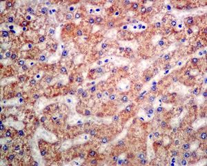 IHC of paraffin-embedded human liver tissue using anti-AK4 antibody.