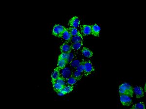 Immunofluorescent staining of HepG2 cells using anti-AK4 antibody.