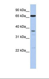 Fetal lung lysate. Antibody concentration: 1.0 ug/ml. Gel concentration: 12%.