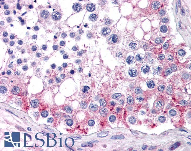 Anti-ABCB9 antibody IHC of human testis. Immunohistochemistry of formalin-fixed, paraffin-embedded tissue after heat-induced antigen retrieval. Antibody LS-B2746 concentration 75 ug/ml.