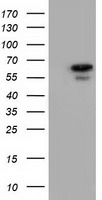 HEK293T cells were transfected with the pCMV6-ENTRY control (Left lane) or pCMV6-ENTRY AK5 (Right lane) cDNA for 48 hrs and lysed. Equivalent amounts of cell lysates (5 ug per lane) were separated by SDS-PAGE and immunoblotted with anti-AK5.