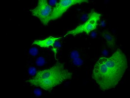 Anti-AK5 mouse monoclonal antibody immunofluorescent staining of COS7 cells transiently transfected by pCMV6-ENTRY AK5.