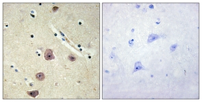 IHC of paraffin-embedded human brain tissue, using AK5 Antibody. The sample on the right was incubated with synthetic peptide.