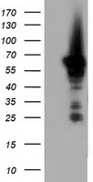 HEK293T cells were transfected with the pCMV6-ENTRY control (Left lane) or pCMV6-ENTRY AK5 (Right lane) cDNA for 48 hrs and lysed. Equivalent amounts of cell lysates (5 ug per lane) were separated by SDS-PAGE and immunoblotted with anti-AK5.