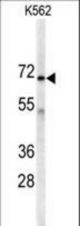 Western blot of anti-AK7 Antibody in K562 cell line lysates (35 ug/lane). AK7(arrow) was detected using the purified antibody.