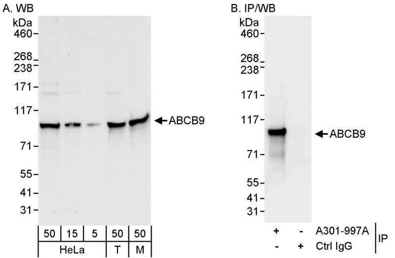 Detection of Human and Mouse ABCB9 by Western Blot (h&m) and Immunoprecipitation (h). Samples: Whole cell lysate from HeLa (5, 15 and 50 ug for WB; 1 mg for IP, 20% of IP loaded), 293T (T; 50 ug) and mouse NIH3T3 (M; 50 ug) cells. Antibodies: Affinity purified rabbit anti-ABCB9 antibody used for WB at 0.04 ug/ml (A) and 1 ug/ml (B) and used for IP at 3 ug/mg lysate. Detection: Chemiluminescence with exposure times of 10 seconds (A) and 3 seconds (B).