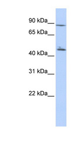 AKD1 / C6orf199 antibody LS-C102645 Western blot of HepG2 cell lysate.