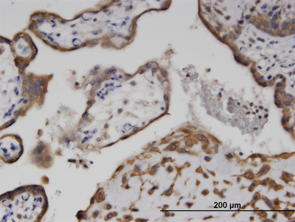 Immunoperoxidase of monoclonal antibody to C6orf199 on formalin-fixed paraffin-embedded human placenta. [antibody concentration 3 ug/ml]