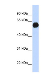 AKAP1 antibody LS-C101624 Western blot of Fetal Brain lysate.