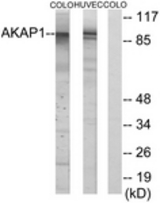 Western blot of extracts from HUVEC/COLO cells, using AKAP1 Antibody. The lane on the right is treated with the synthesized peptide.