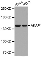 Western blot analysis of extracts of various cell lines, using AKAP1 antibody.
