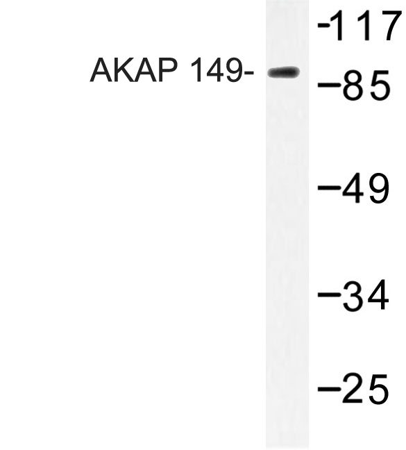 Western blot of AKAP 149(N306) pAb in extracts from HUVEC cells.