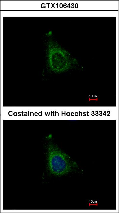 Immunofluorescence of methanol-fixed HeLa using AKAP10 antibody at 1:500 dilution.