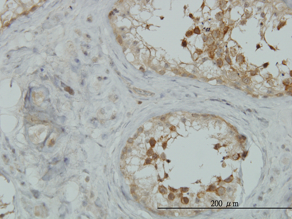 Immunoperoxidase of monoclonal antibody to AKAP10 on formalin-fixed paraffin-embedded human testis. [antibody concentration 0.5 ug/ml]