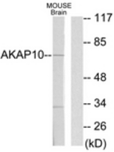 Western blot of extracts from mouse brain cells, using AKAP10 Antibody. The lane on the right is treated with the synthesized peptide.