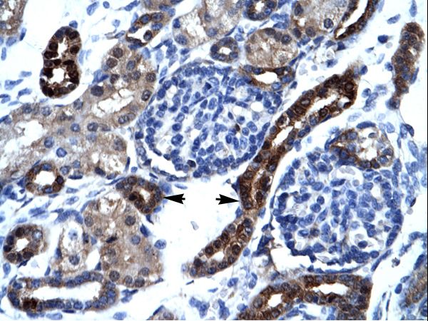 AKAP17A / SFRS17A antibody LS-C29827 was used in IHC to stain formalin-fixed, paraffin-embedded human kidney.