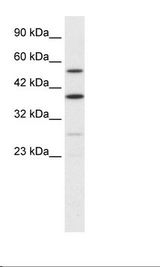 Jurkat Cell Lysate