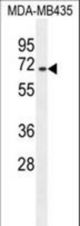 SFRS17A Antibody western blot of MDA-MB435 cell line lysates (35 ug/lane). The SFRS17A antibody detected the SFRS17A protein (arrow).