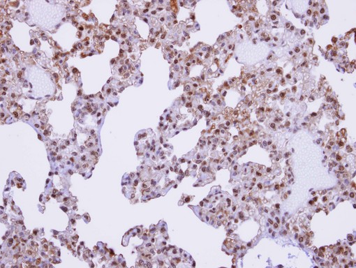 IHC of paraffin-embedded lung using XE7 antibody at 1:100 dilution.