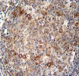ABCC10 antibody immunohistochemistry of formalin-fixed and paraffin-embedded human tonsil tissue followed by peroxidase-conjugated secondary antibody and DAB staining.