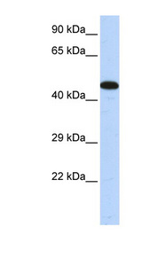 AKAP5 antibody LS-C101623 Western blot of Fetal Muscle lysate.