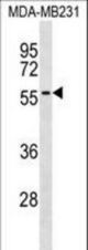 AKAP5 Antibody western blot of MDA-MB231 cell line lysates (35 ug/lane). The AKAP5 antibody detected the AKAP5 protein (arrow).